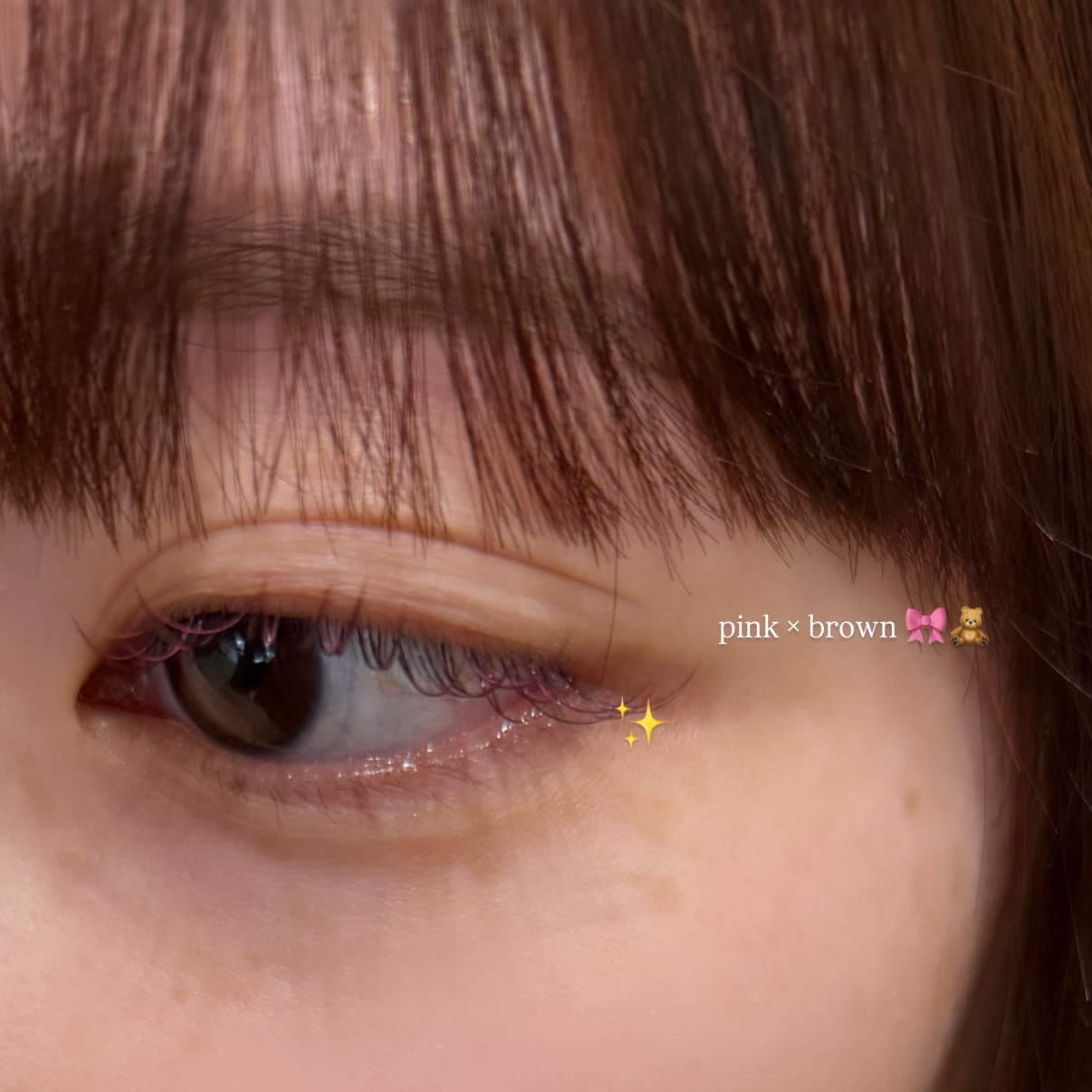 reimtm__eye