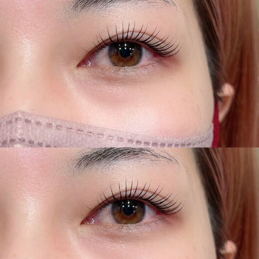 shi_eye33