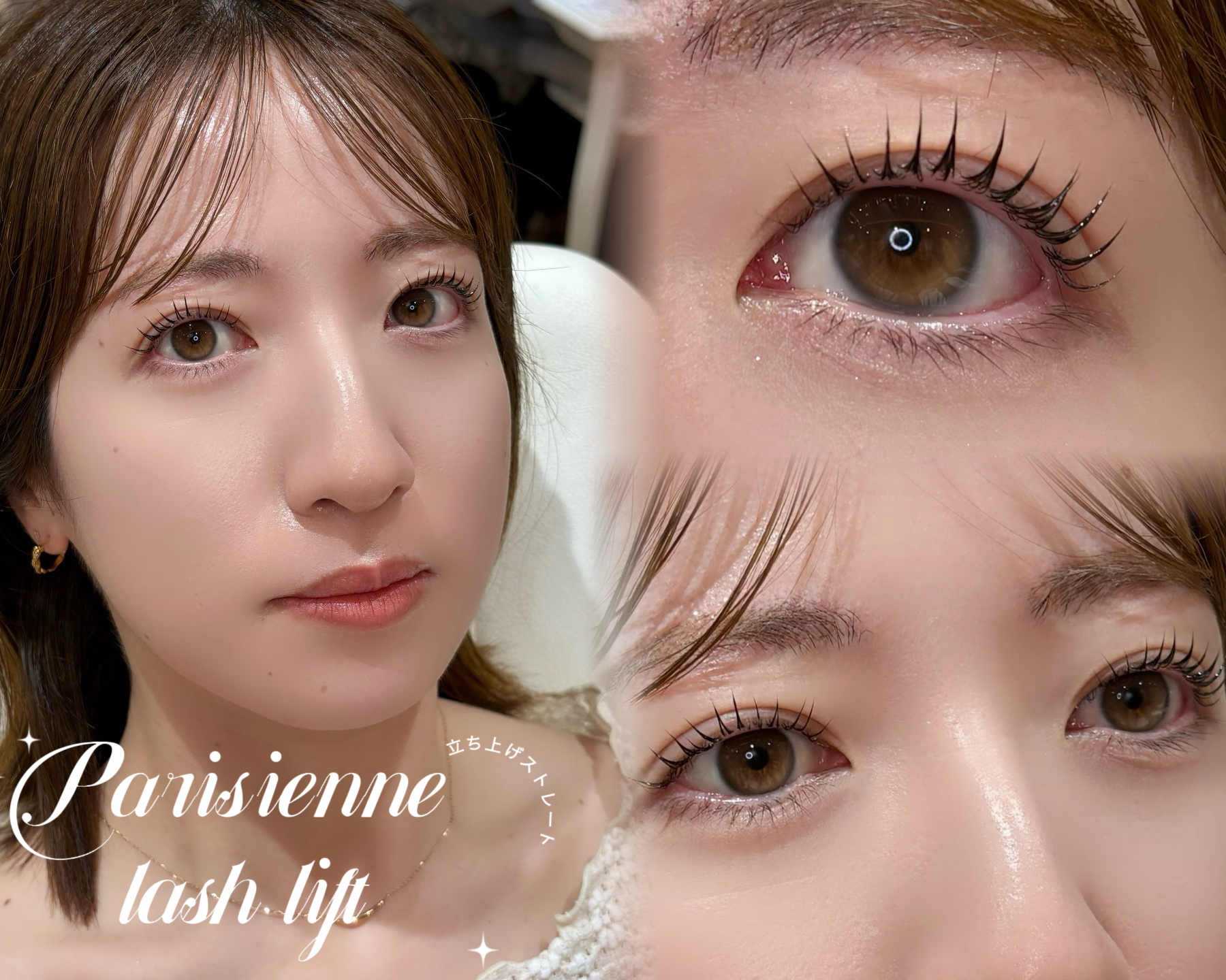 ym_eye_