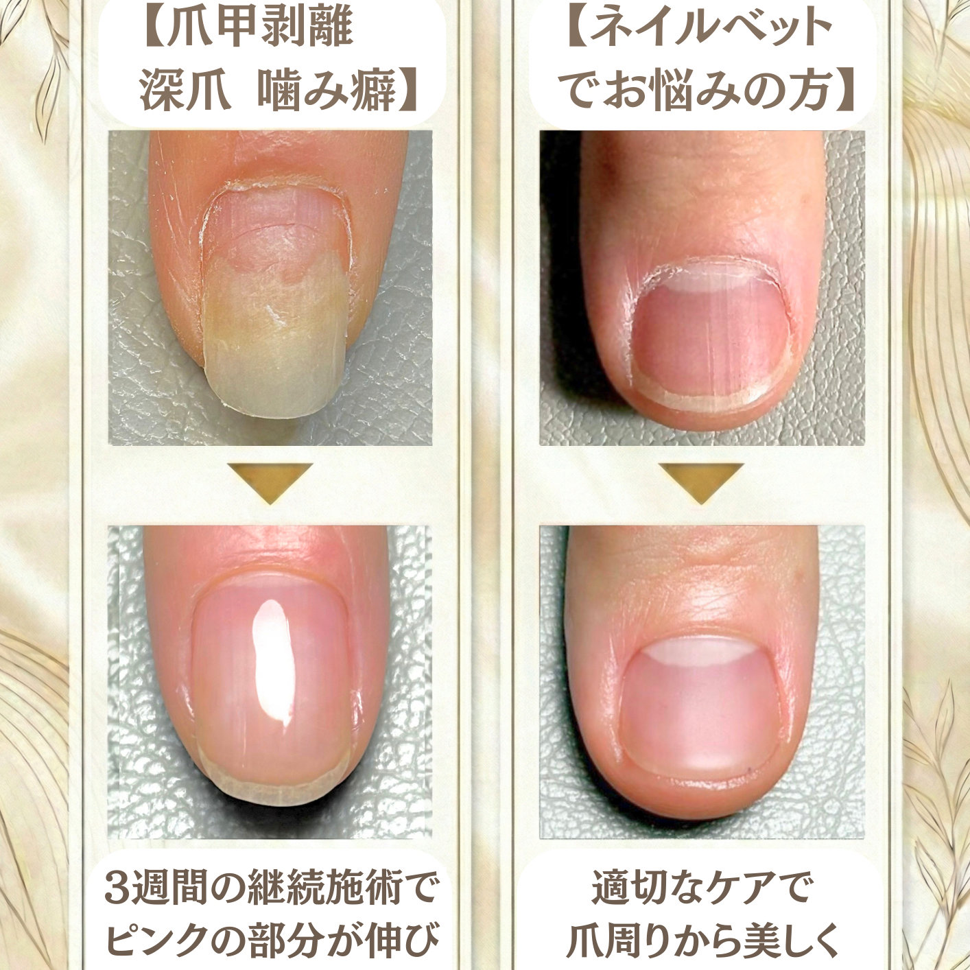 raik_nail