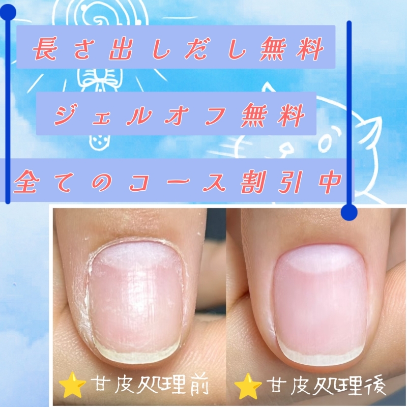NFY_CHIAKI_NailForYou