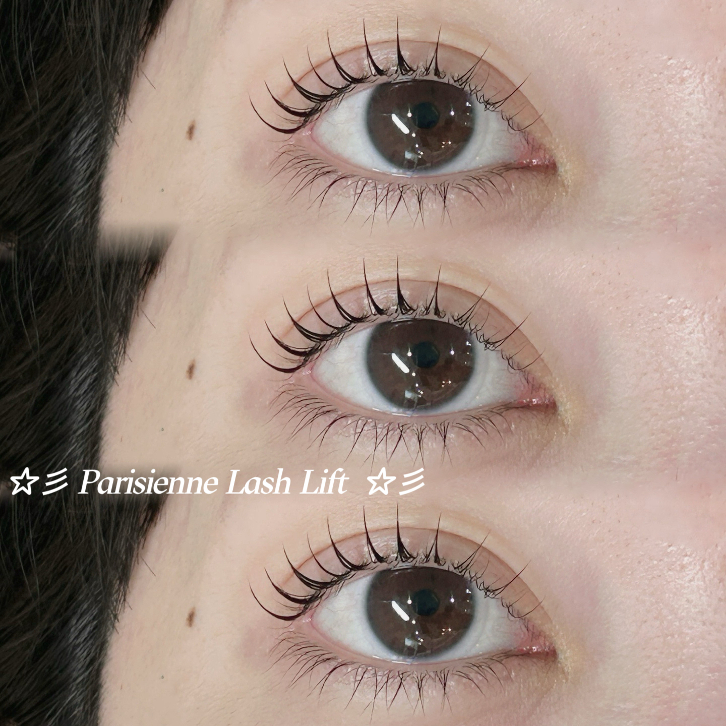 mio_trueye