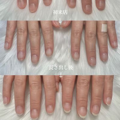 深爪育成