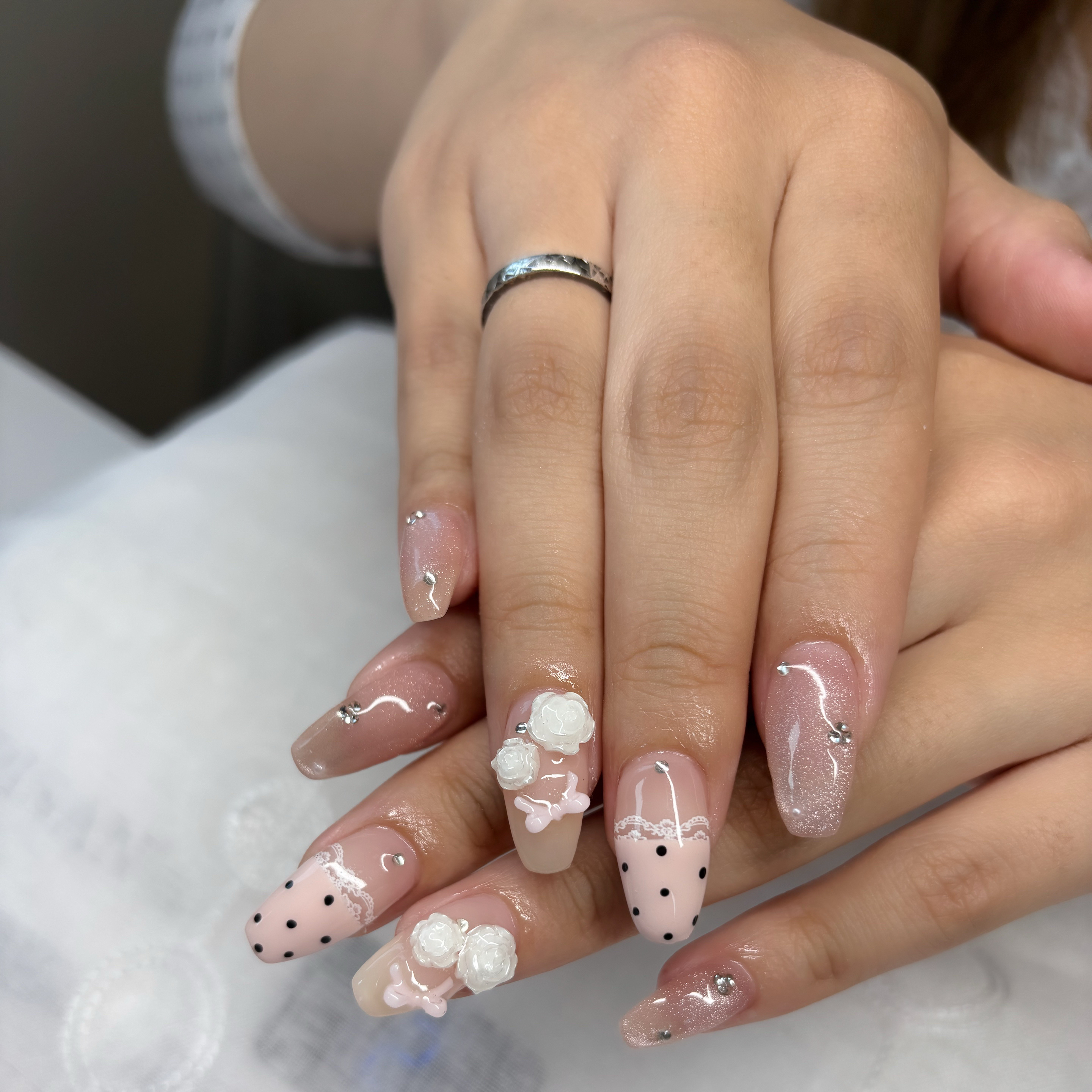 trangnail
