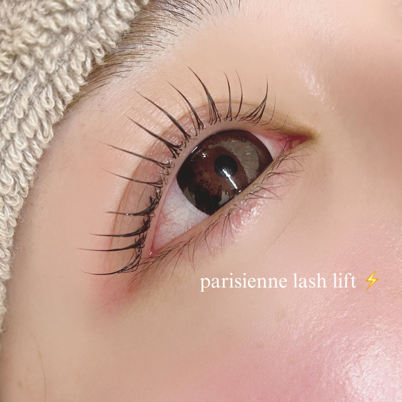 eye_rinka