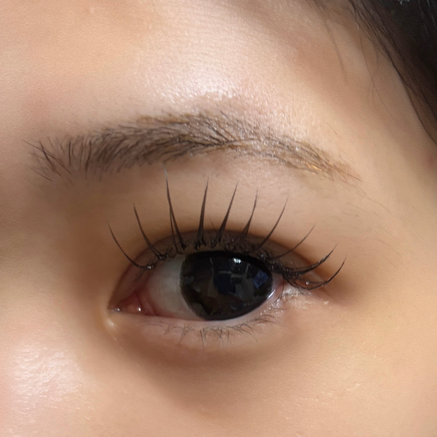 aoi__trueye