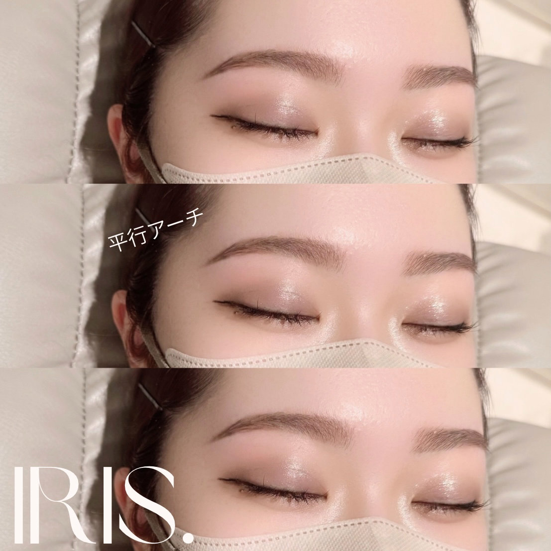 IRIS._rina