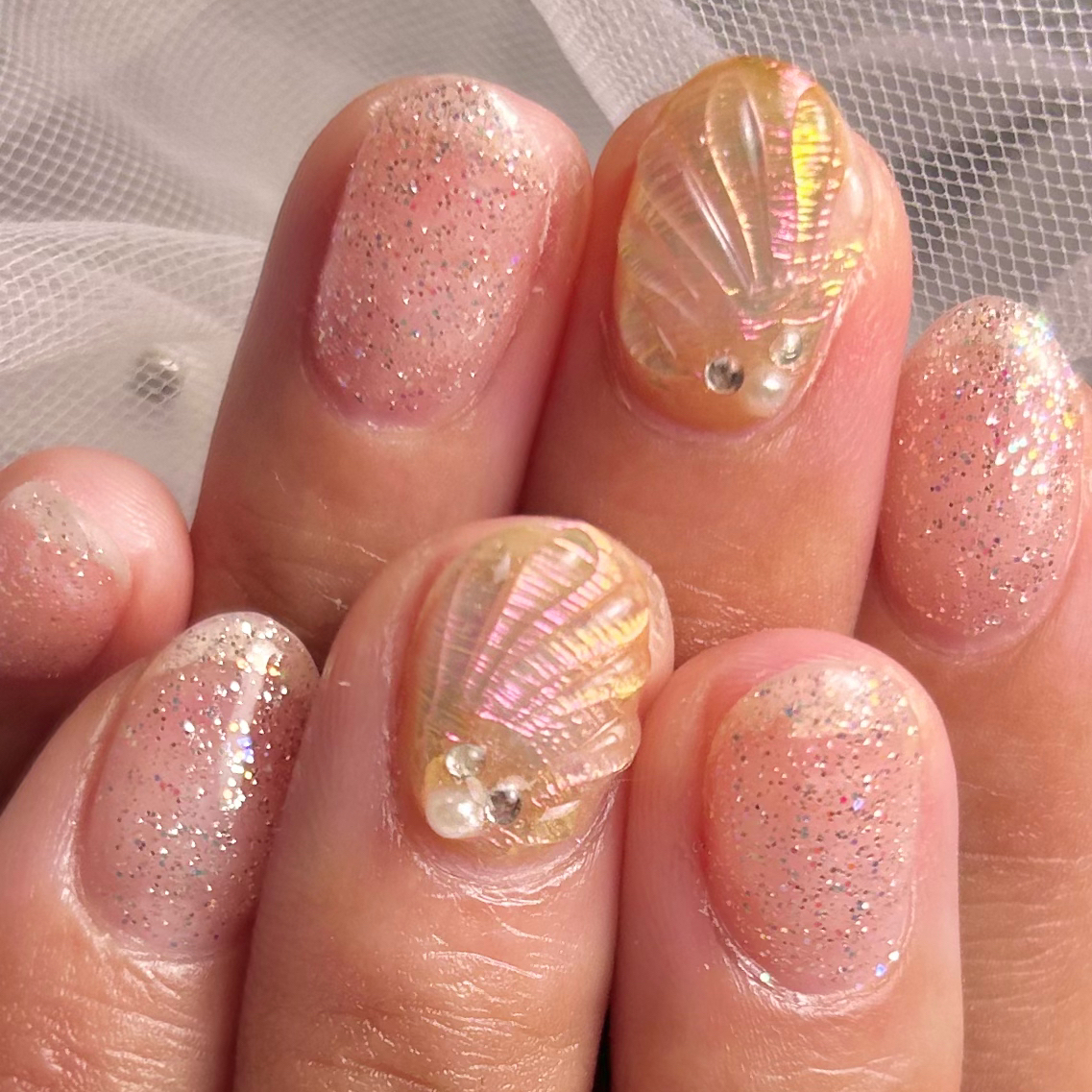 iter_nail_mio