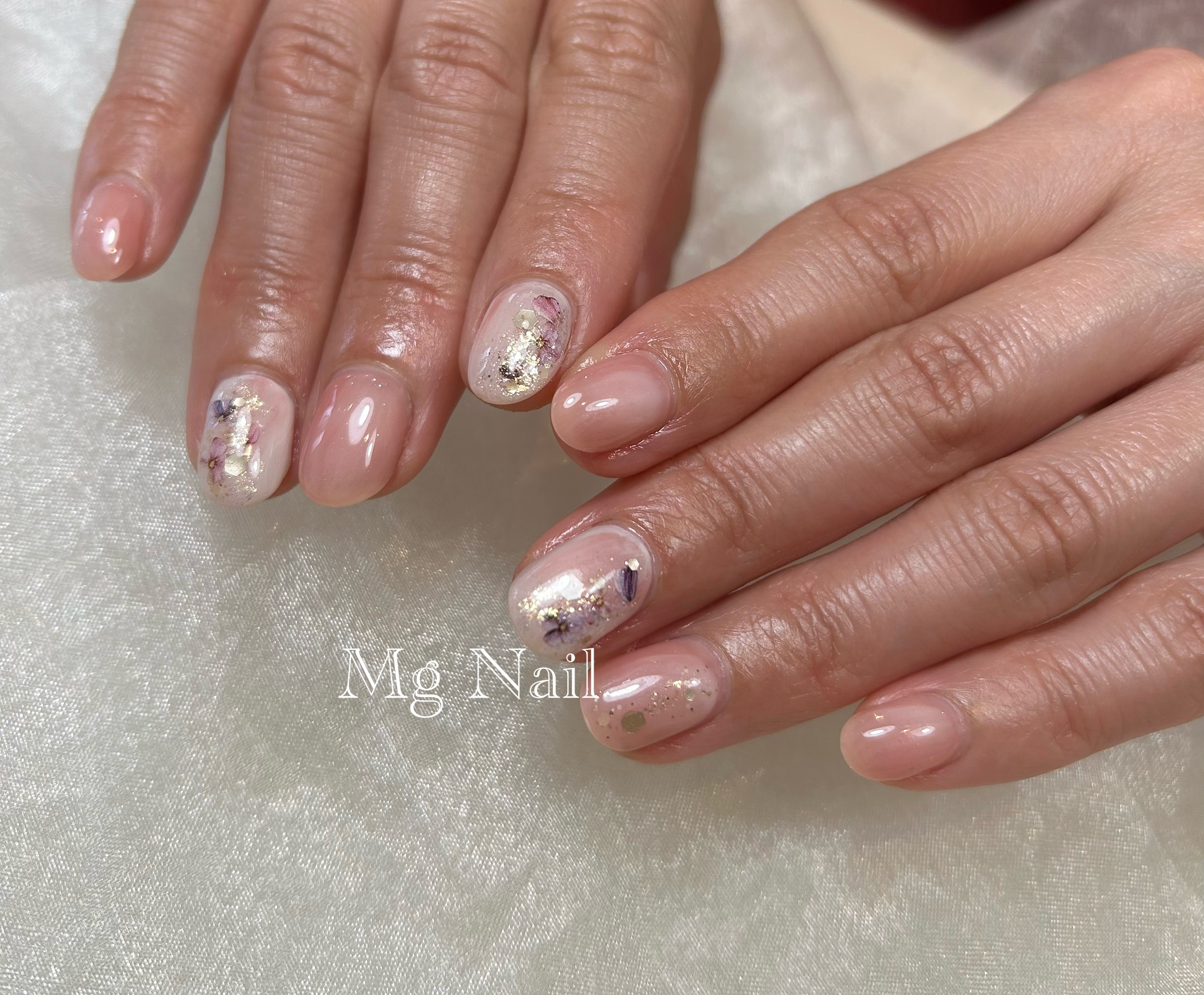 Mg_Nail_