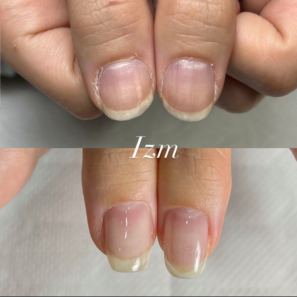 nail_izm