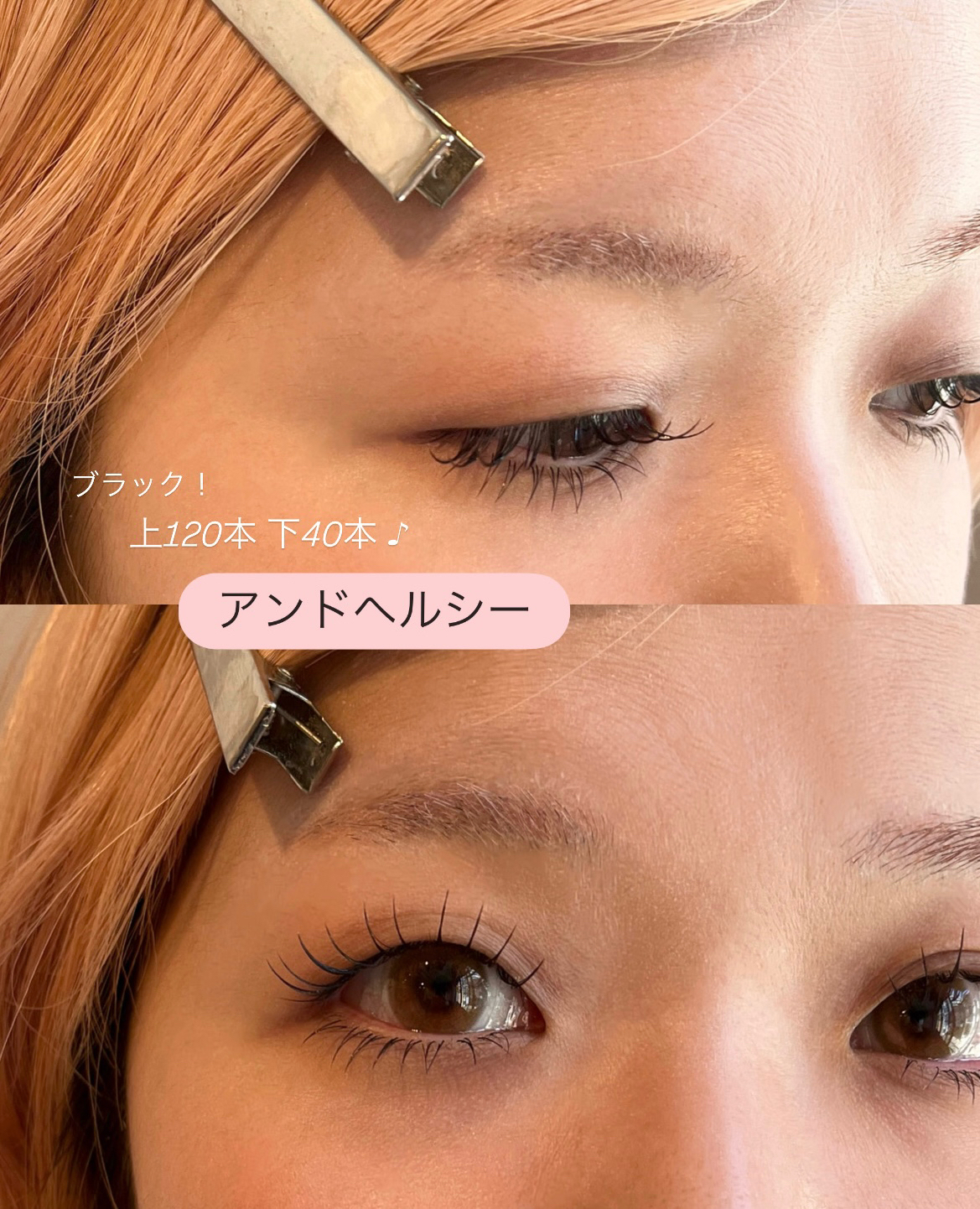 eye_yyy