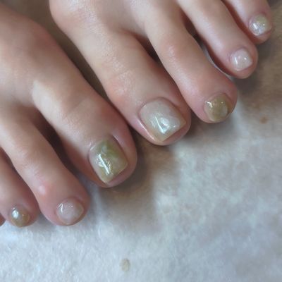 フットシンプル