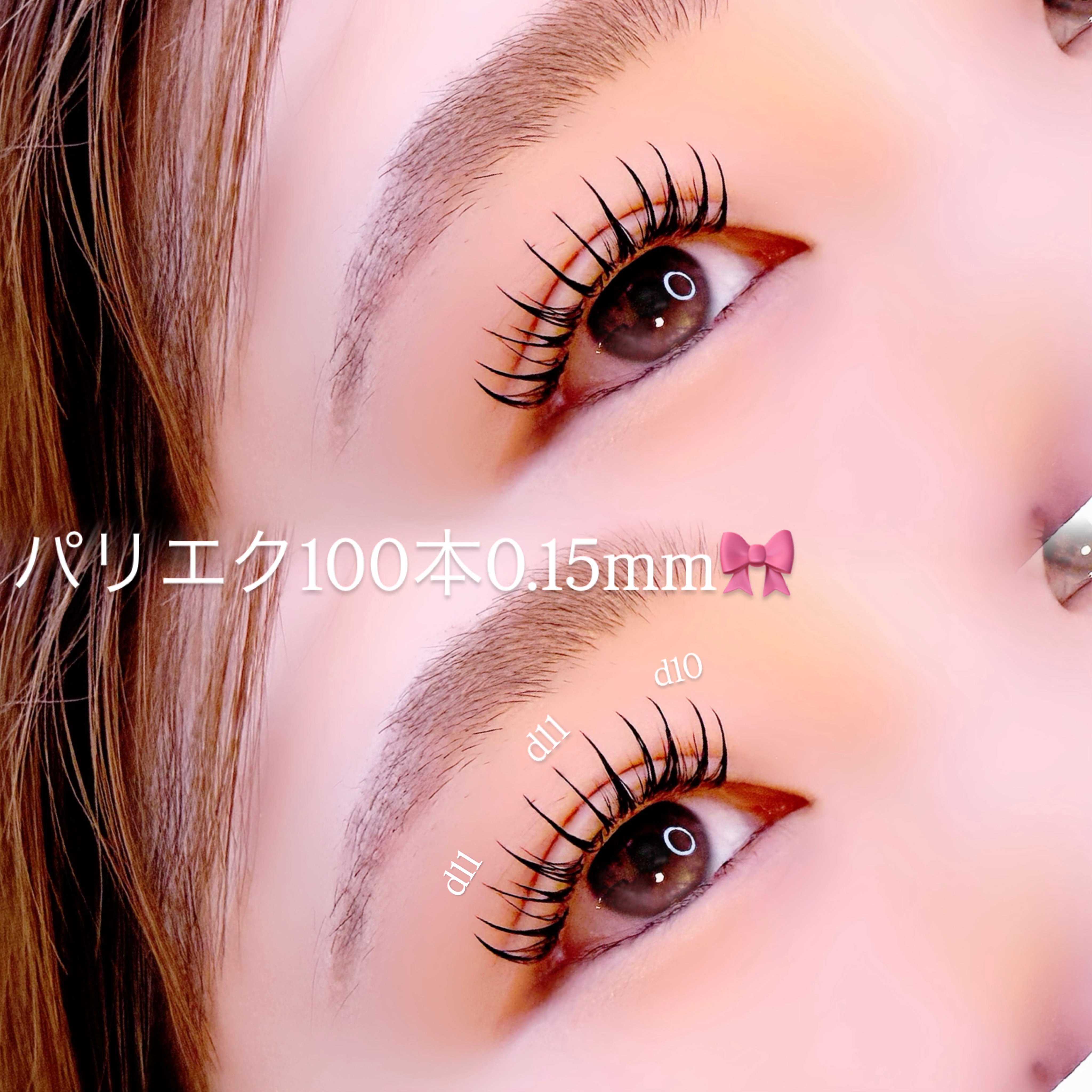 _lurer
