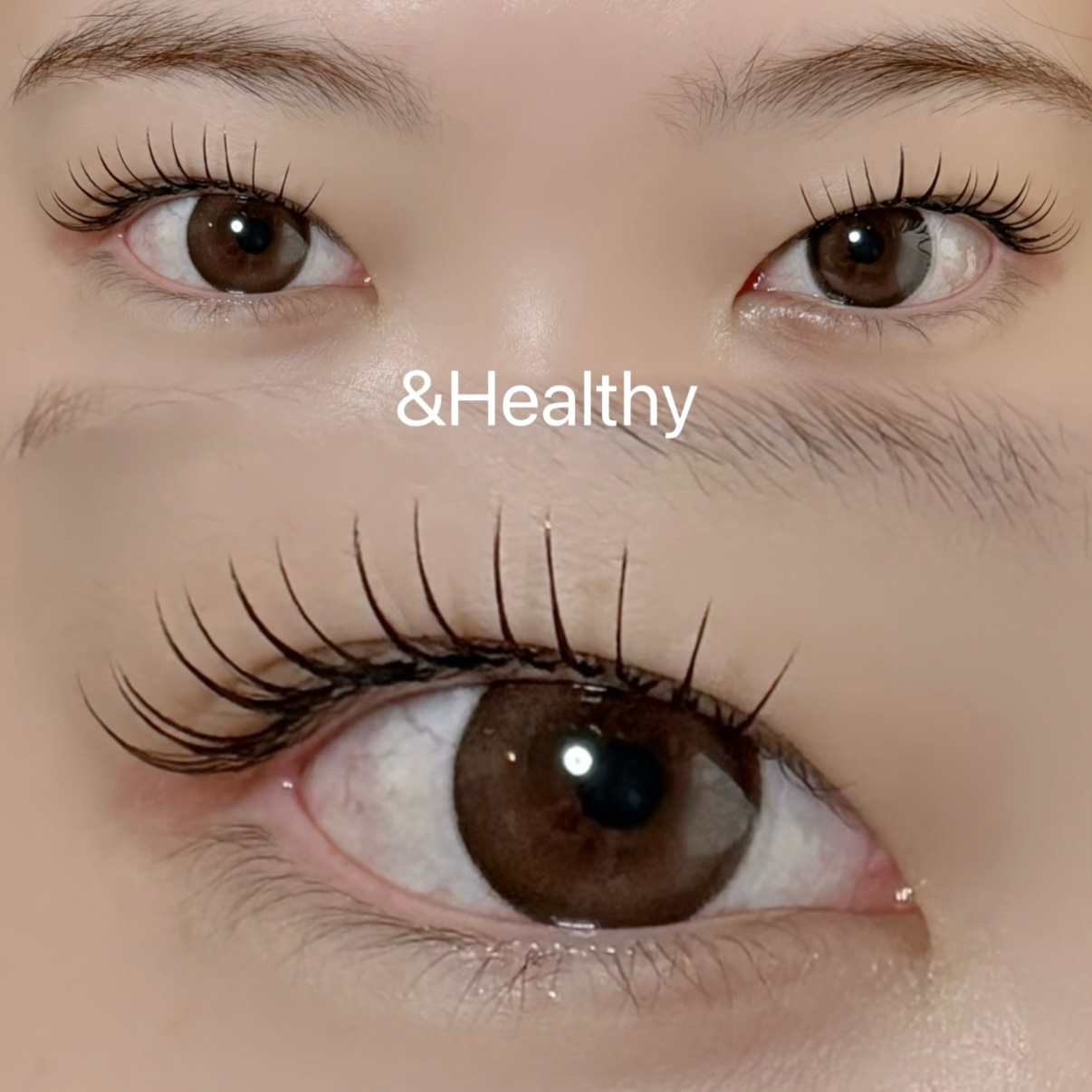 R_LASH