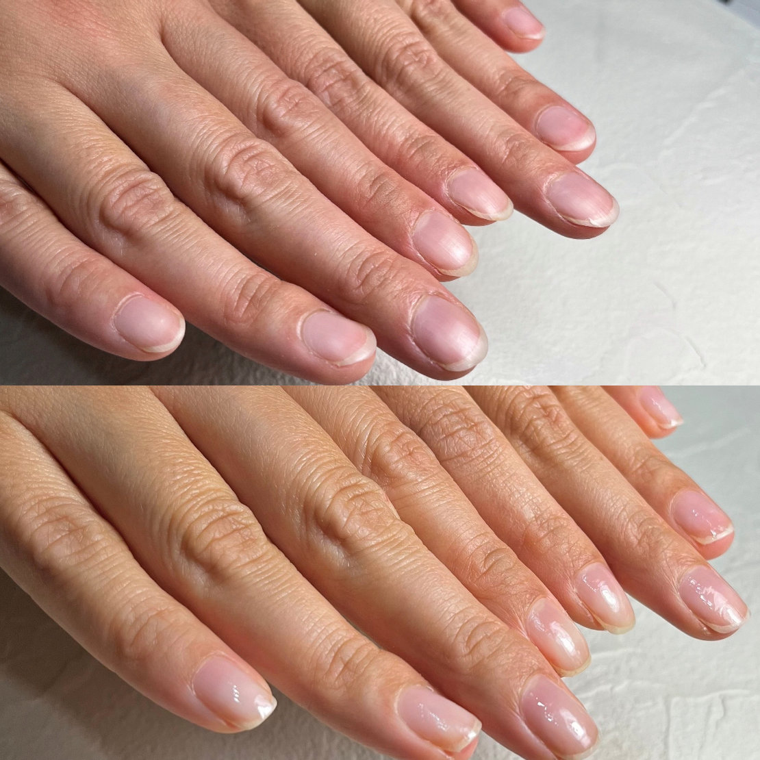 nail_izm