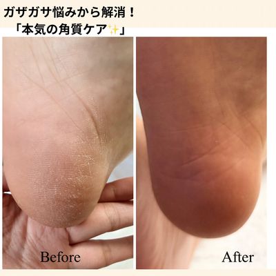 さようなら👋ガチガチかかと