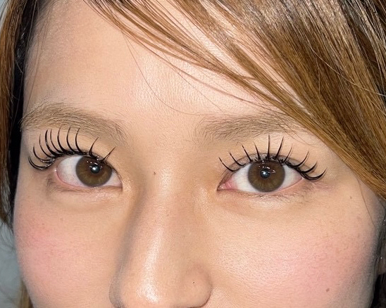 soome_eyeskin