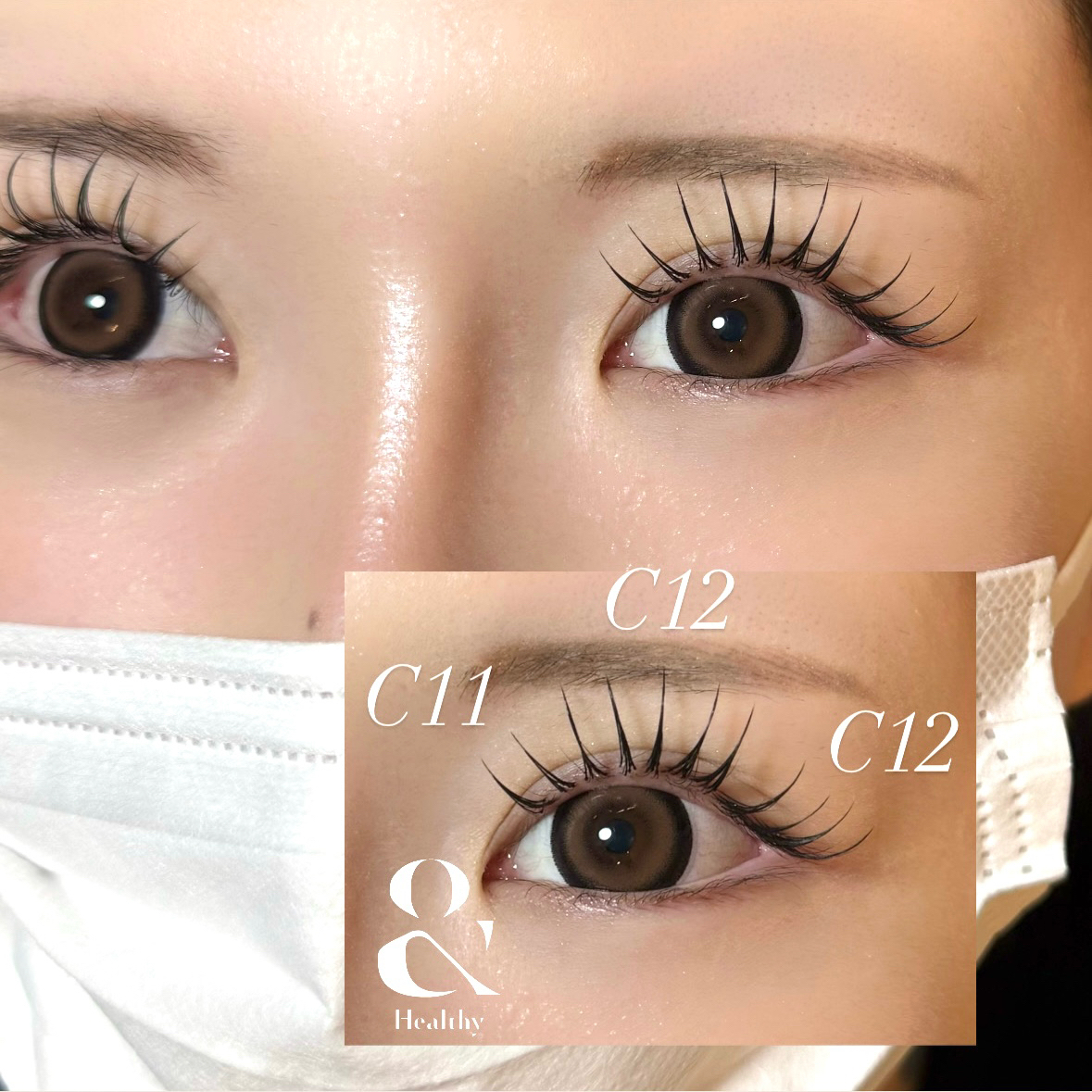 eye___ramu