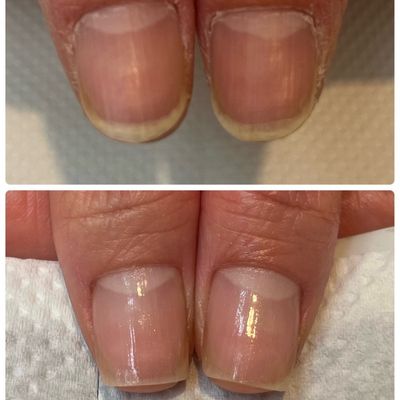 最強のネイルケア
