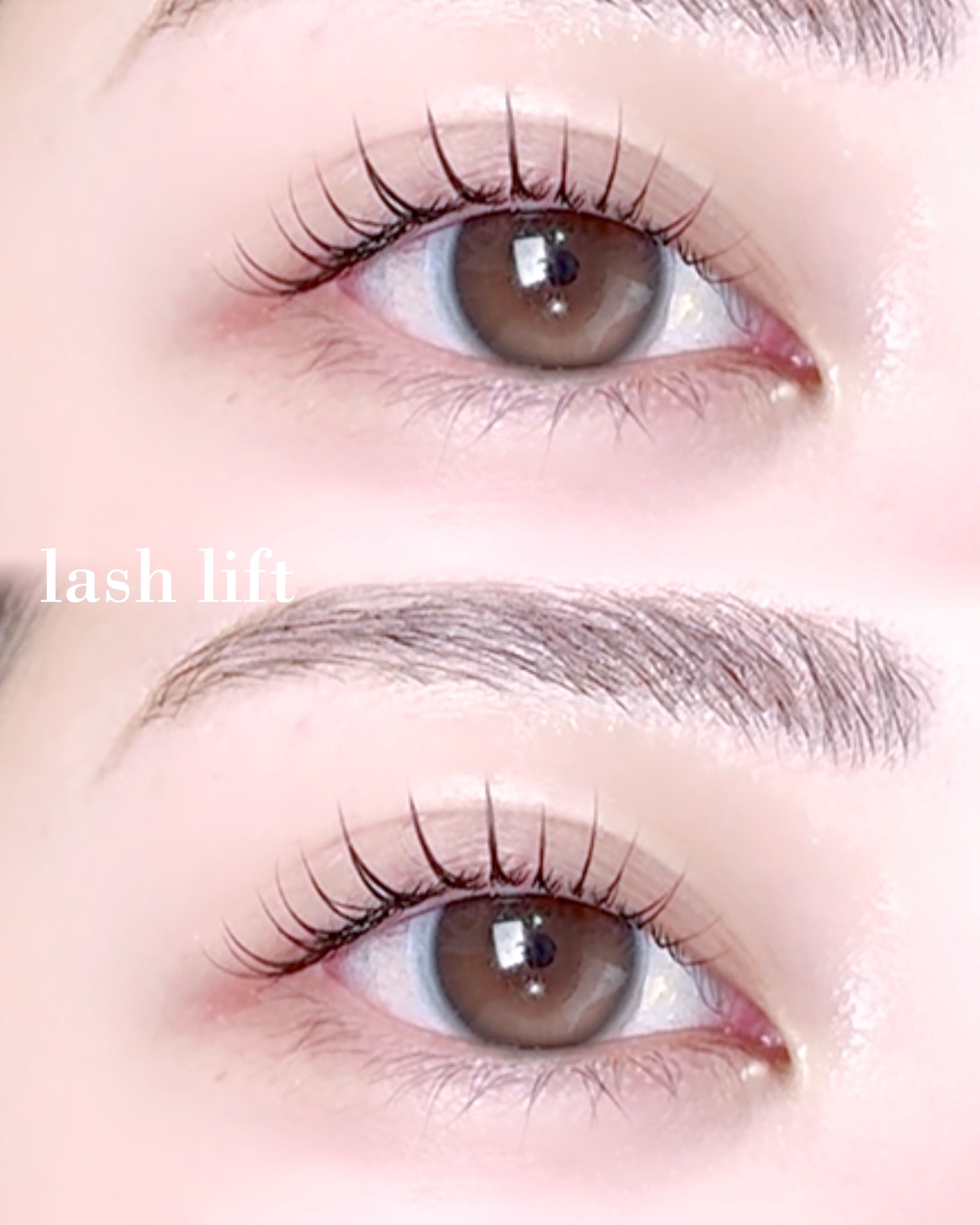 MEI_eye