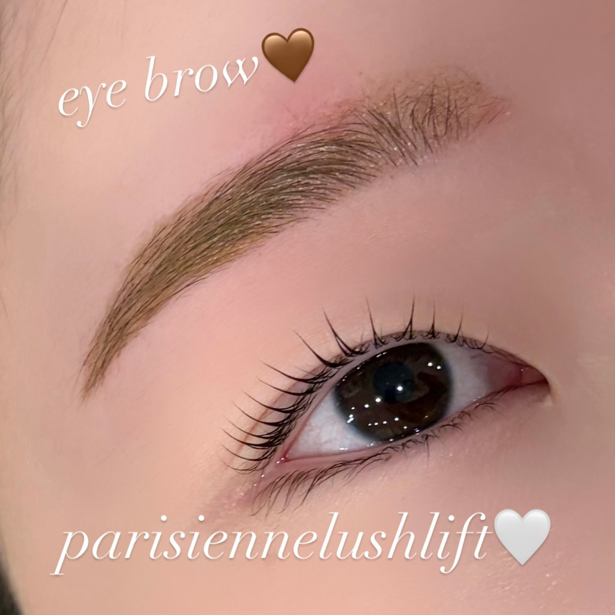 runa._trueye
