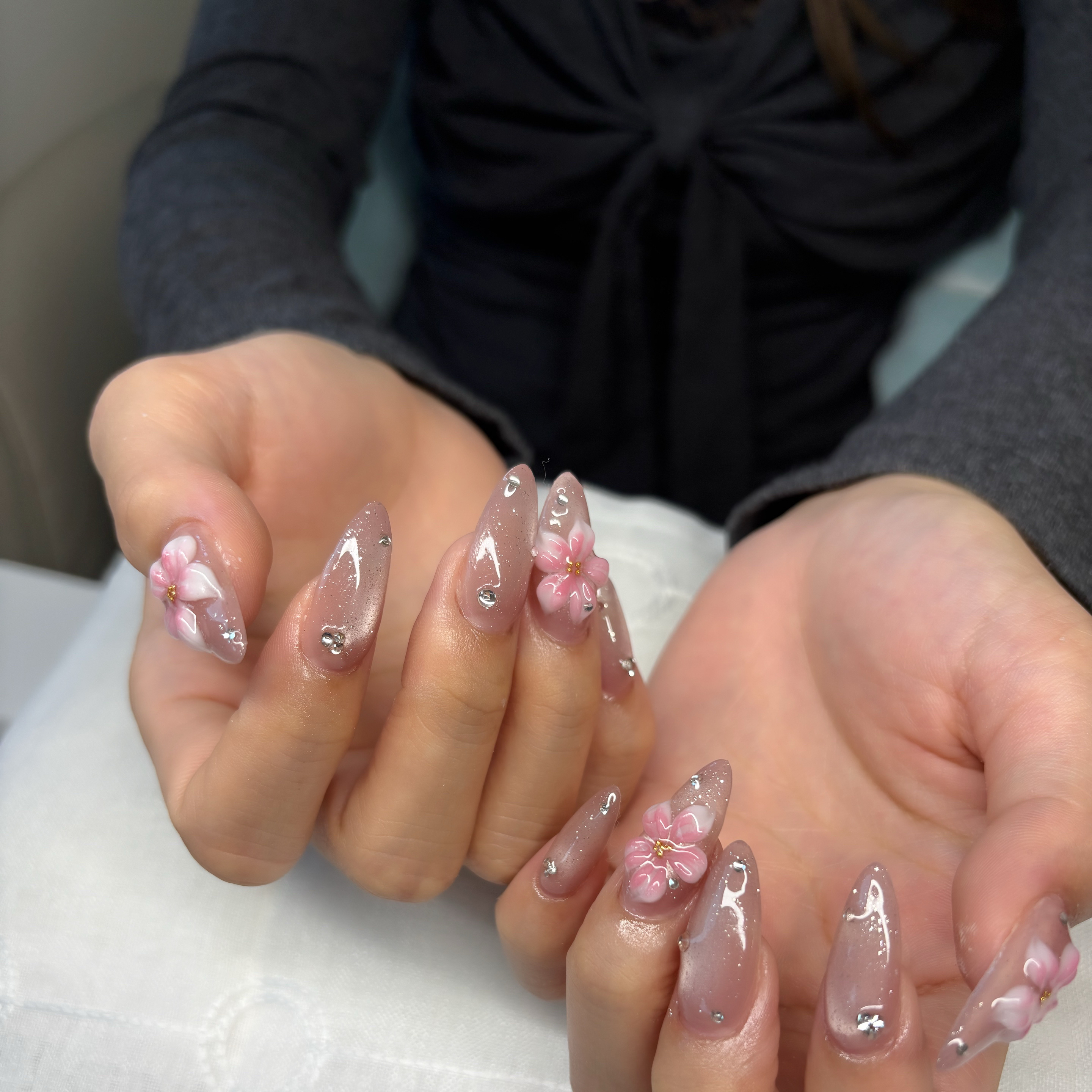 trangnail