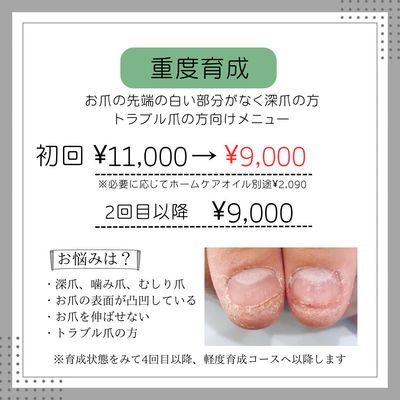 (重度)自爪育成コース¥11000→¥9000
※ご予約前にメッセージ必須