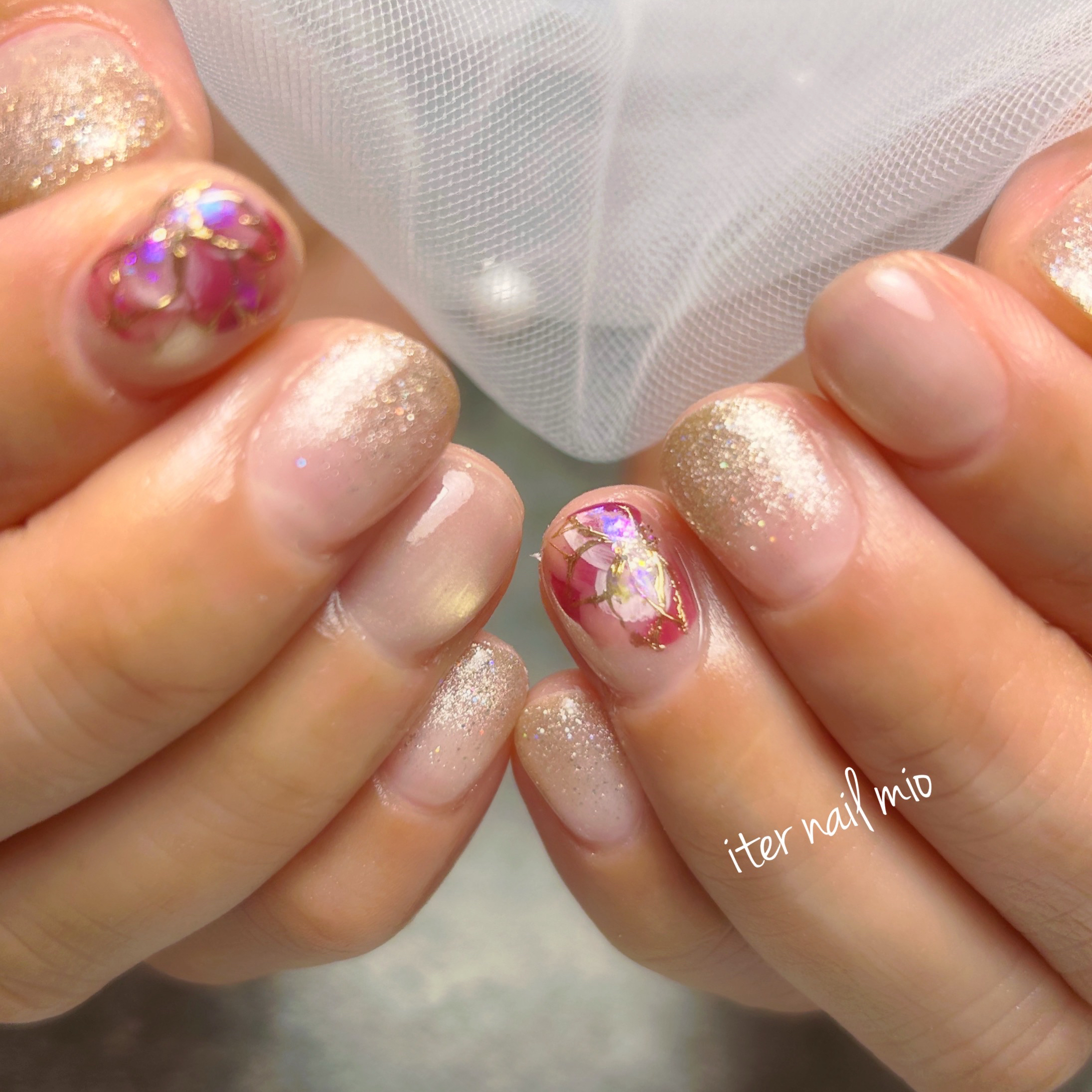 iter_nail_mio