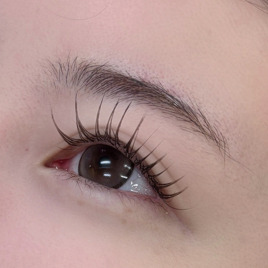 aoi__trueye
