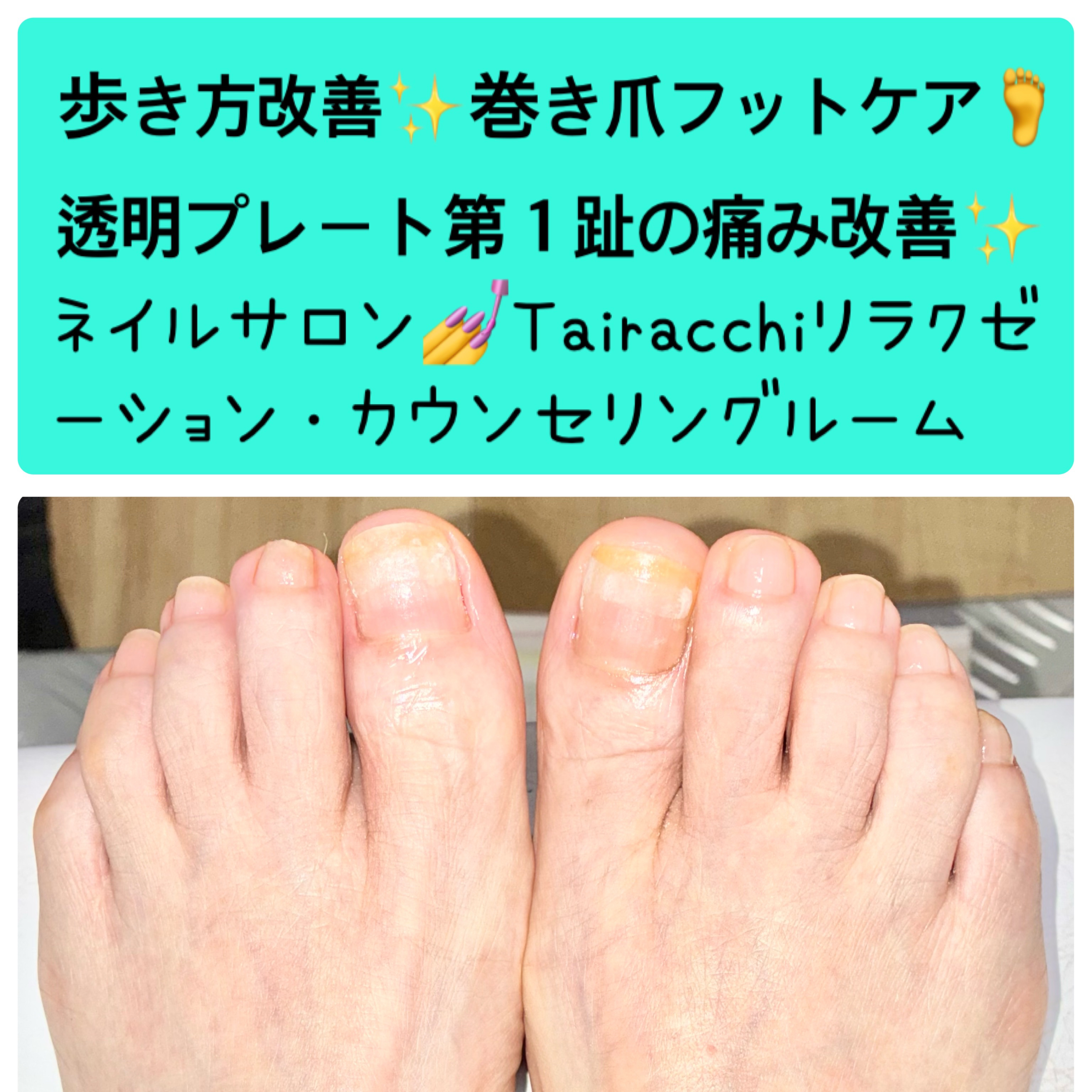 Tairacch_