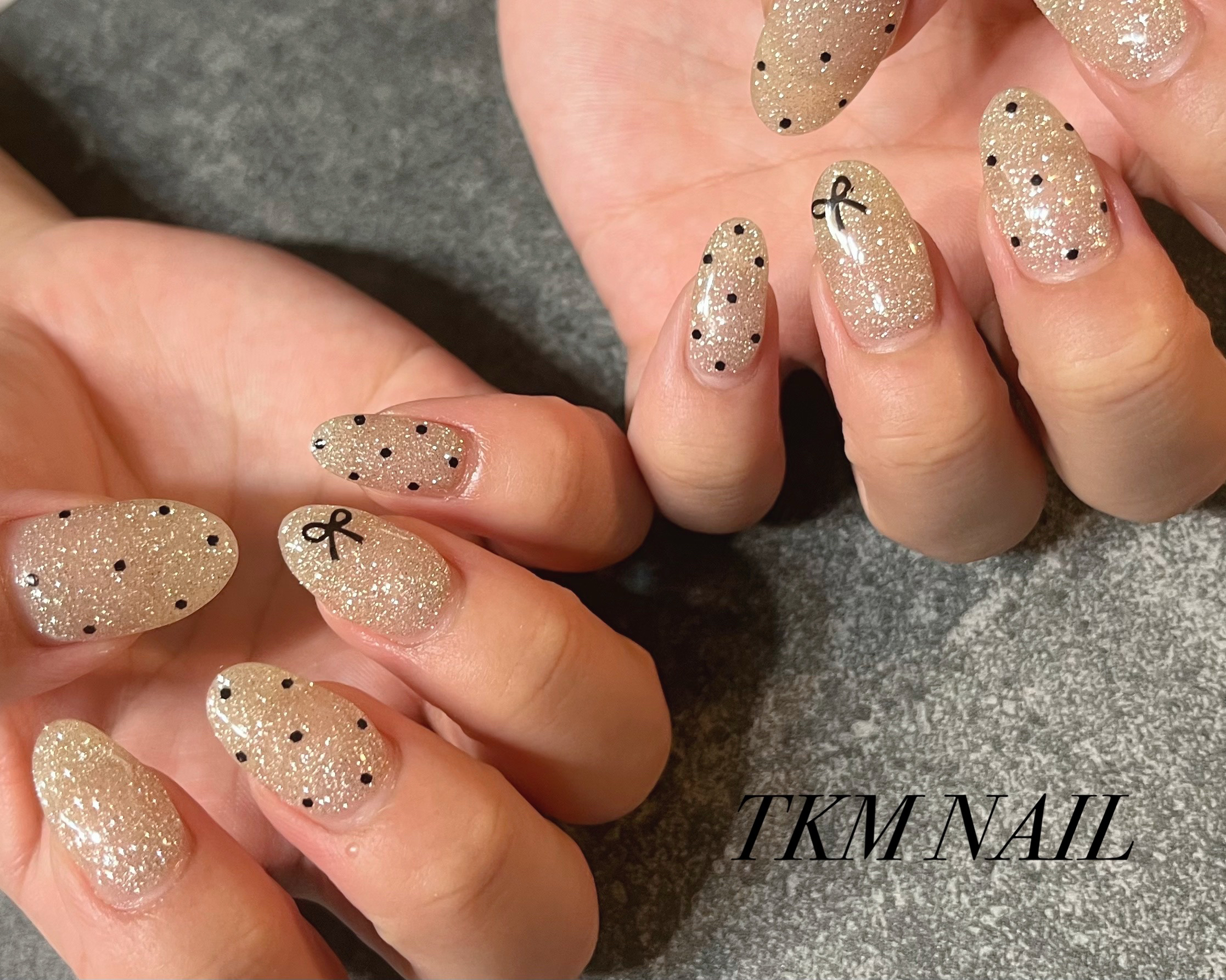 TKM_NAIL