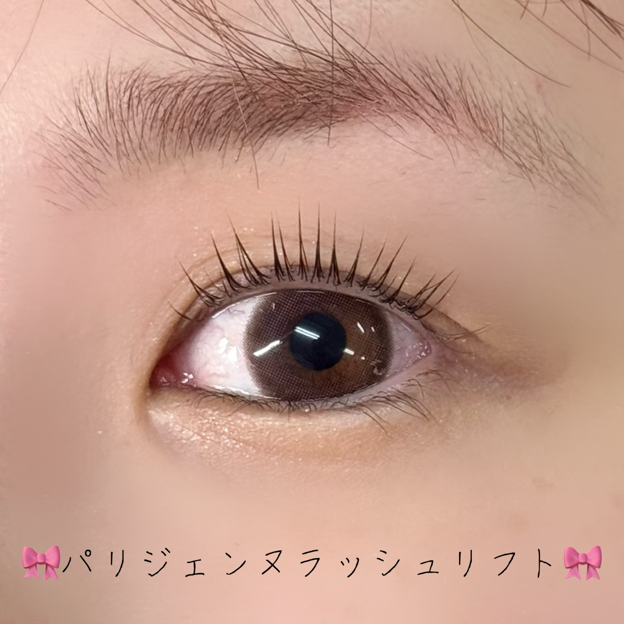 hinata_trueye