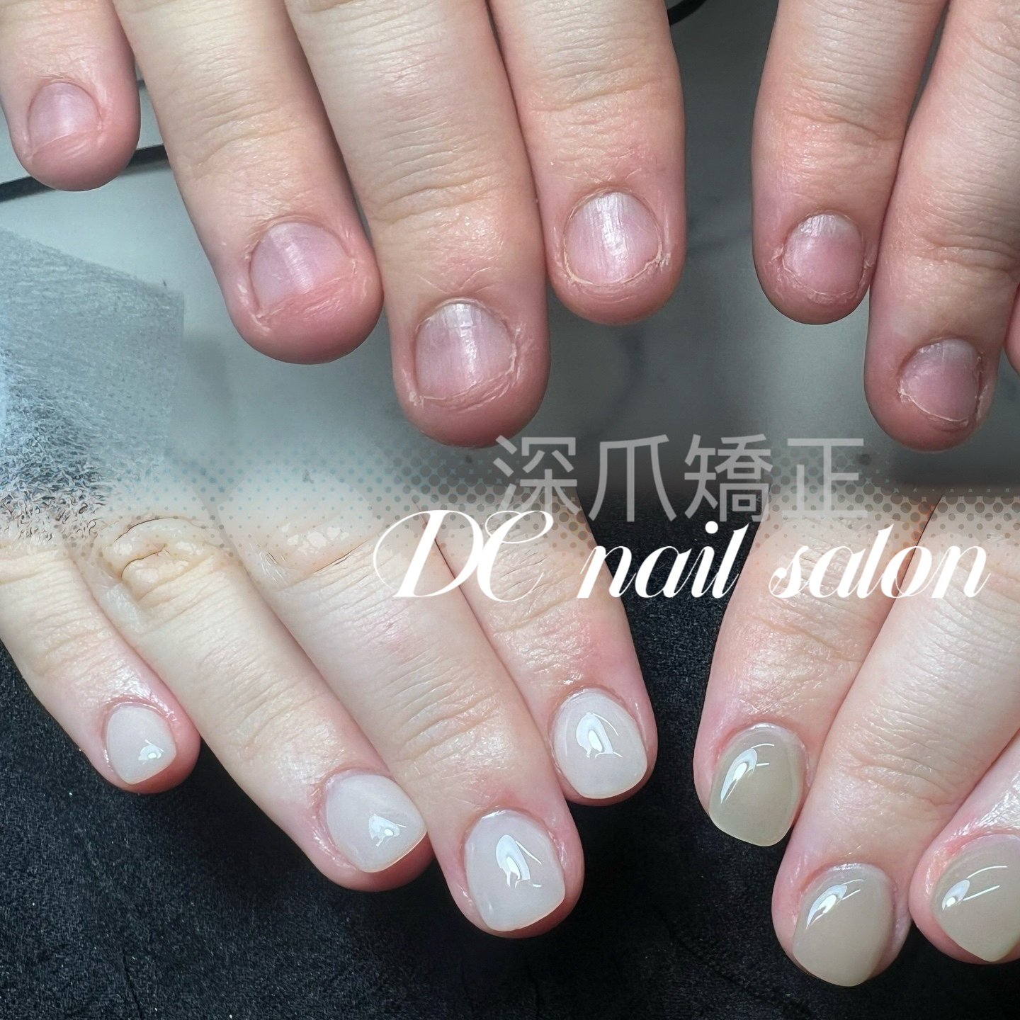 DC_nail