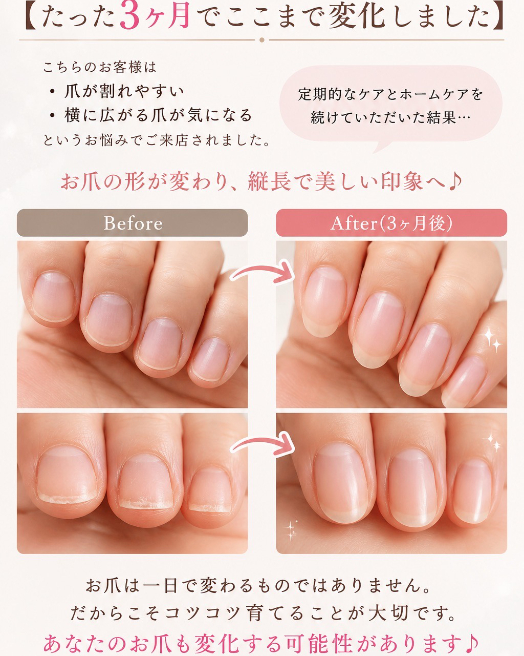 roue.nail