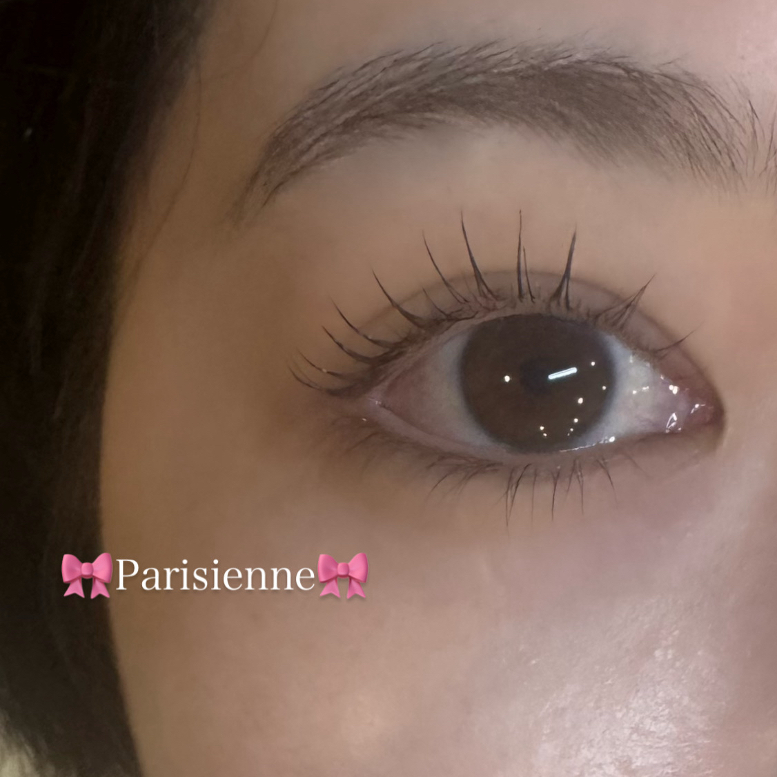 runa_trueye