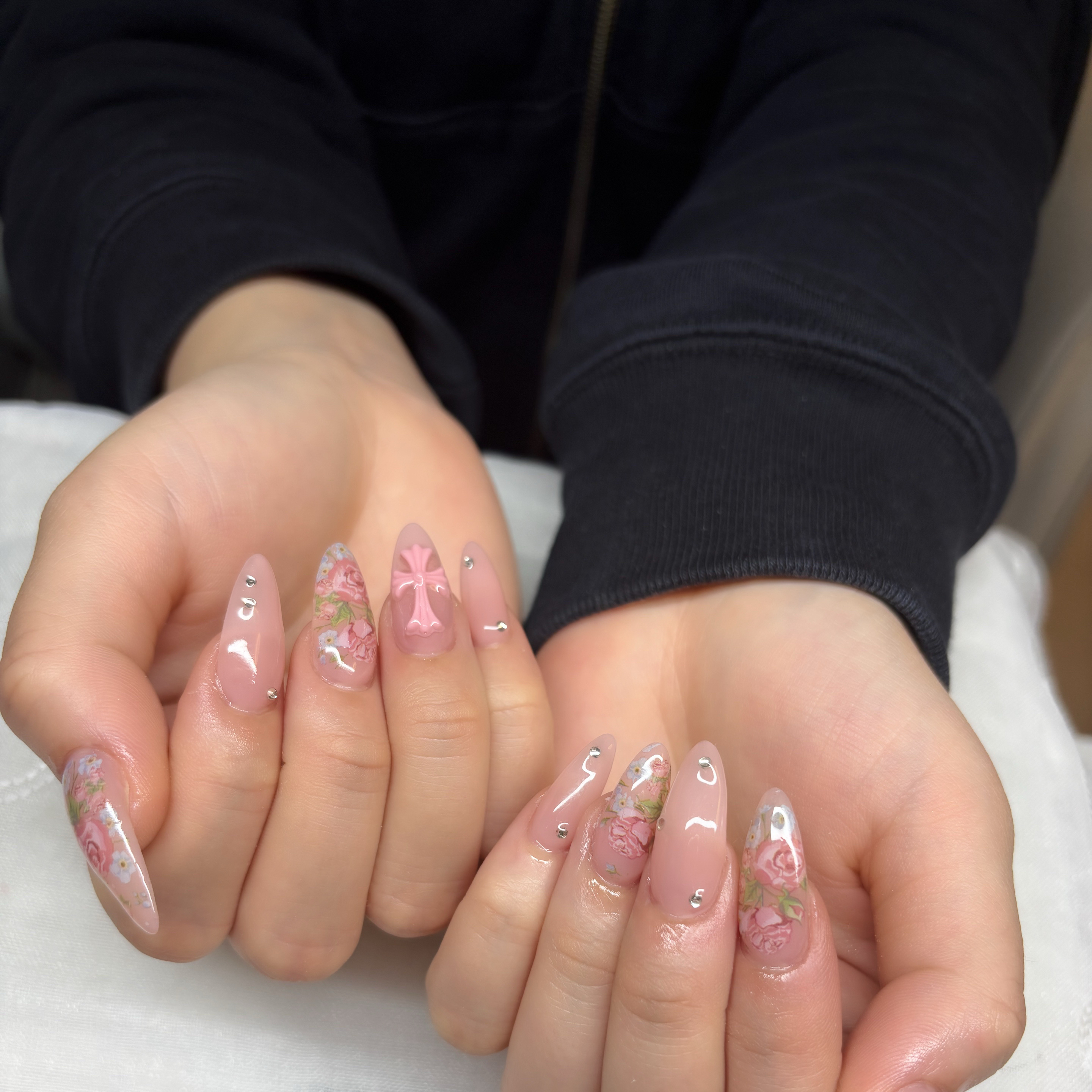 trangnail