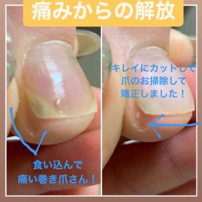 【foot】フットケアのみ★フットバスケア付き