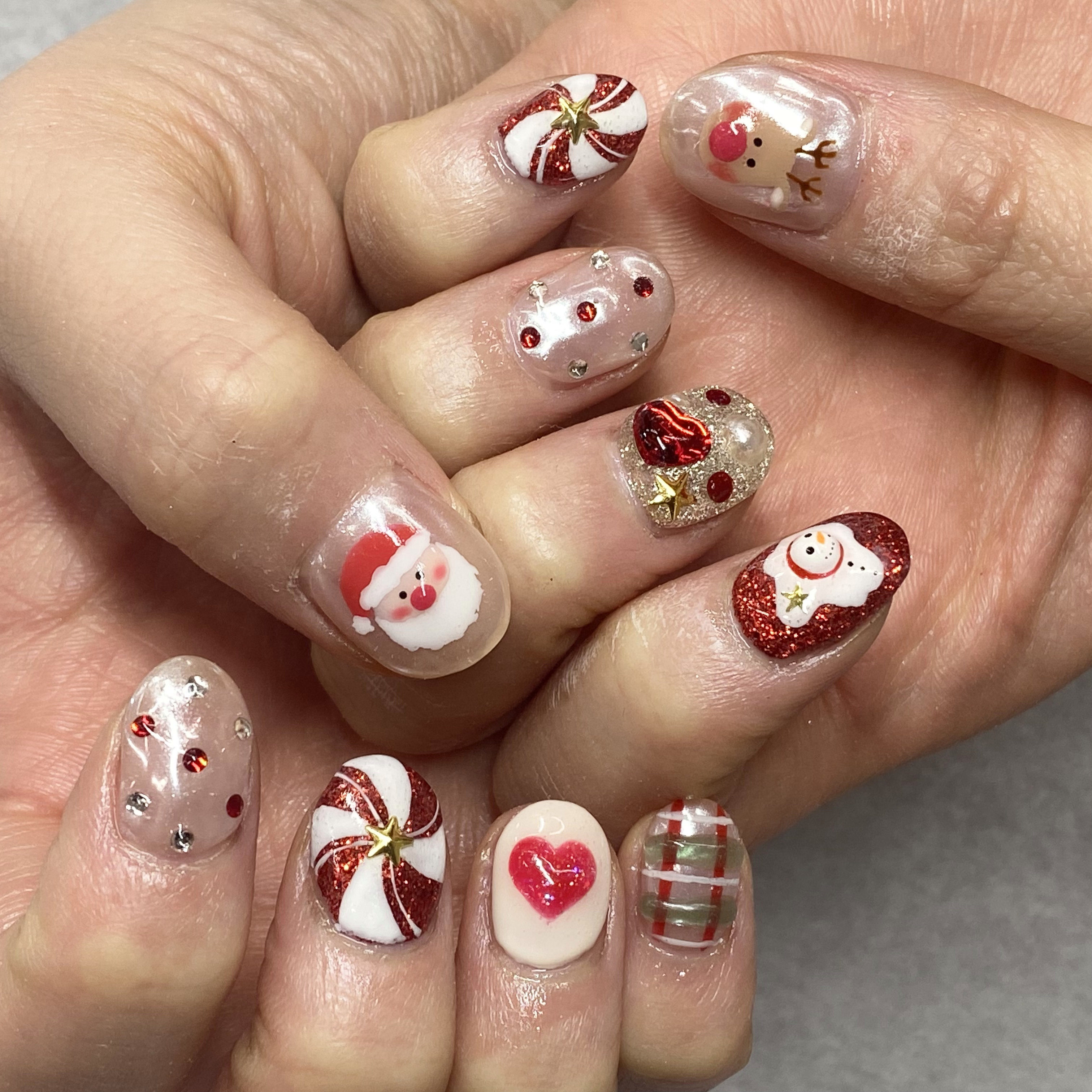NAIL_2