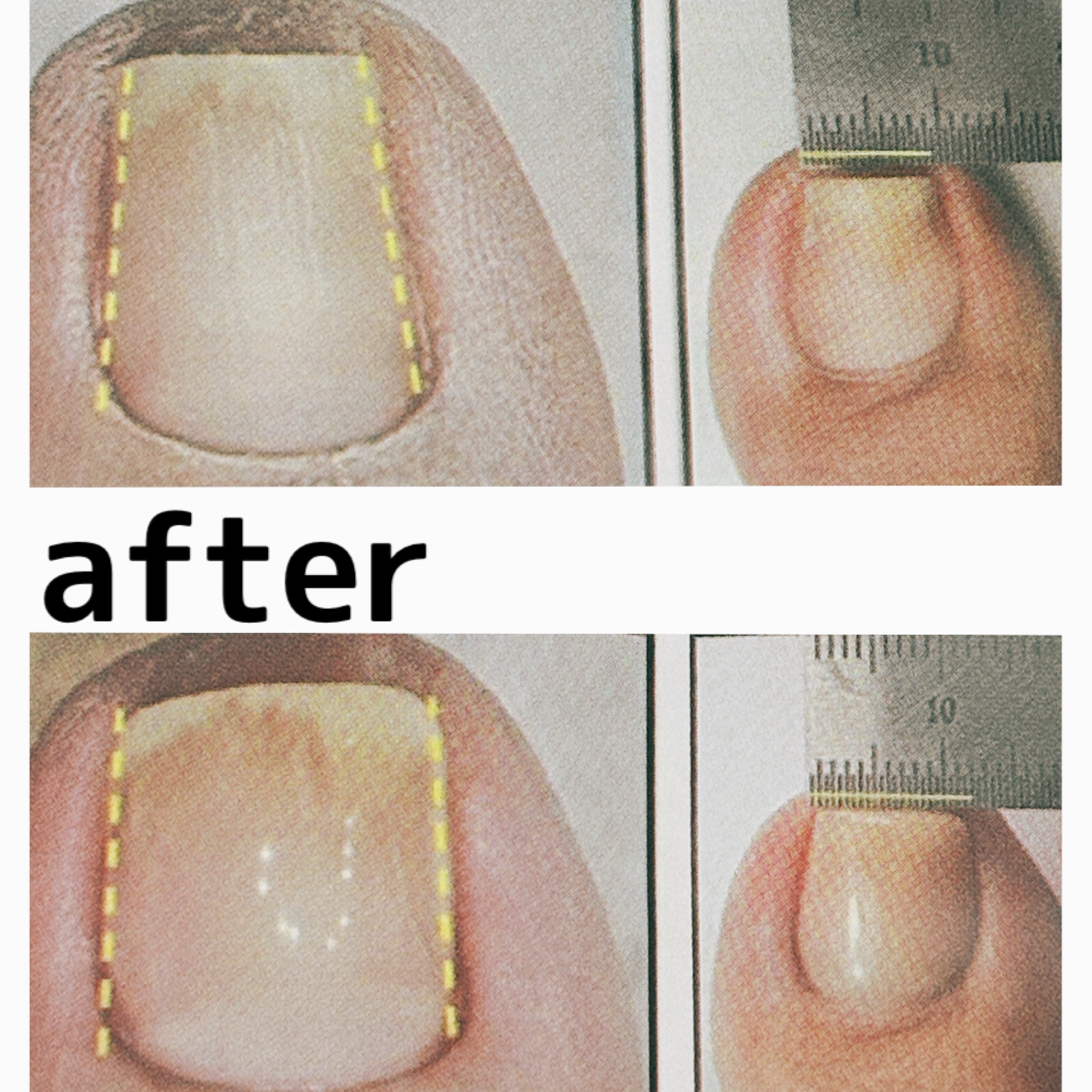 nailkpit