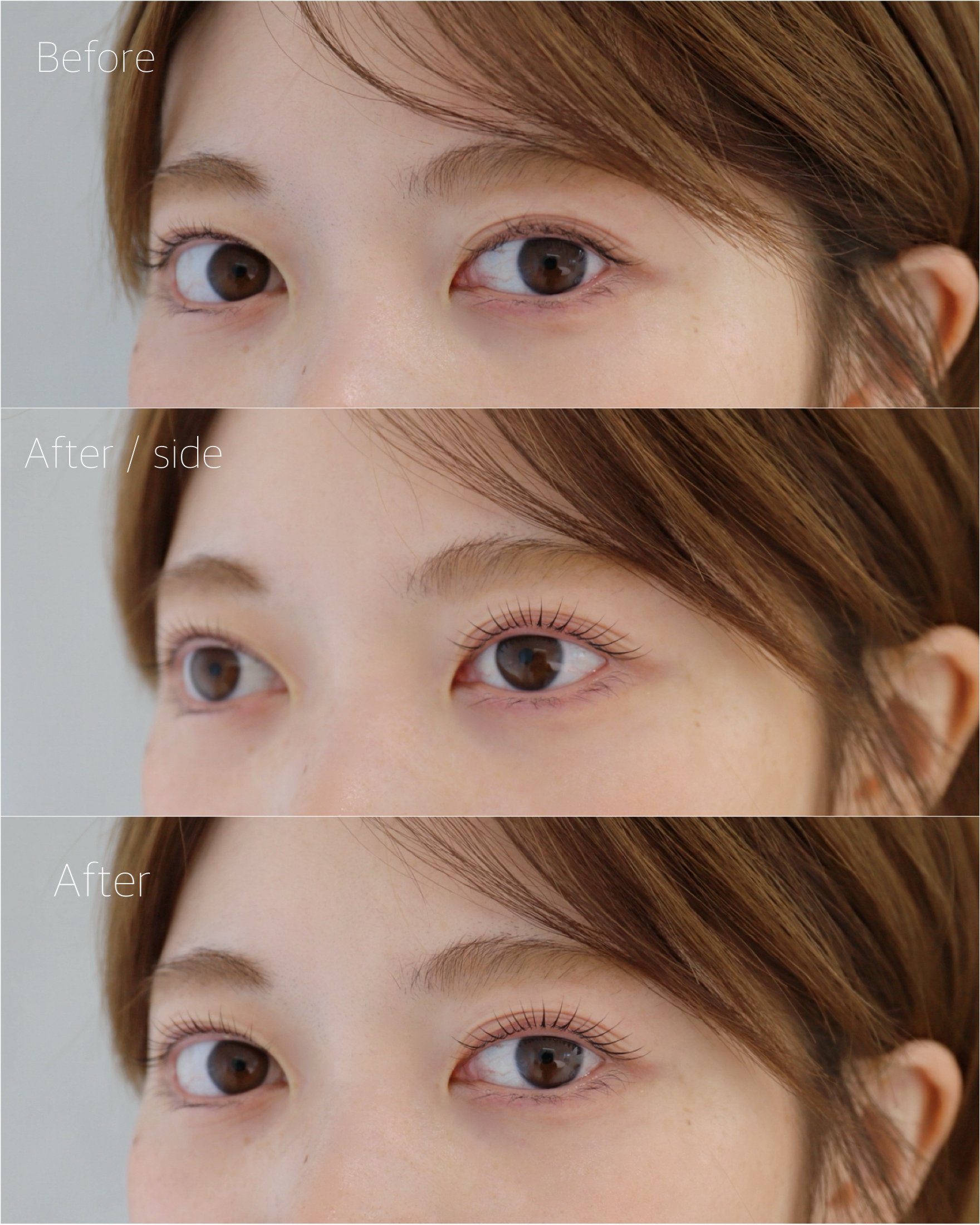 ode_eye