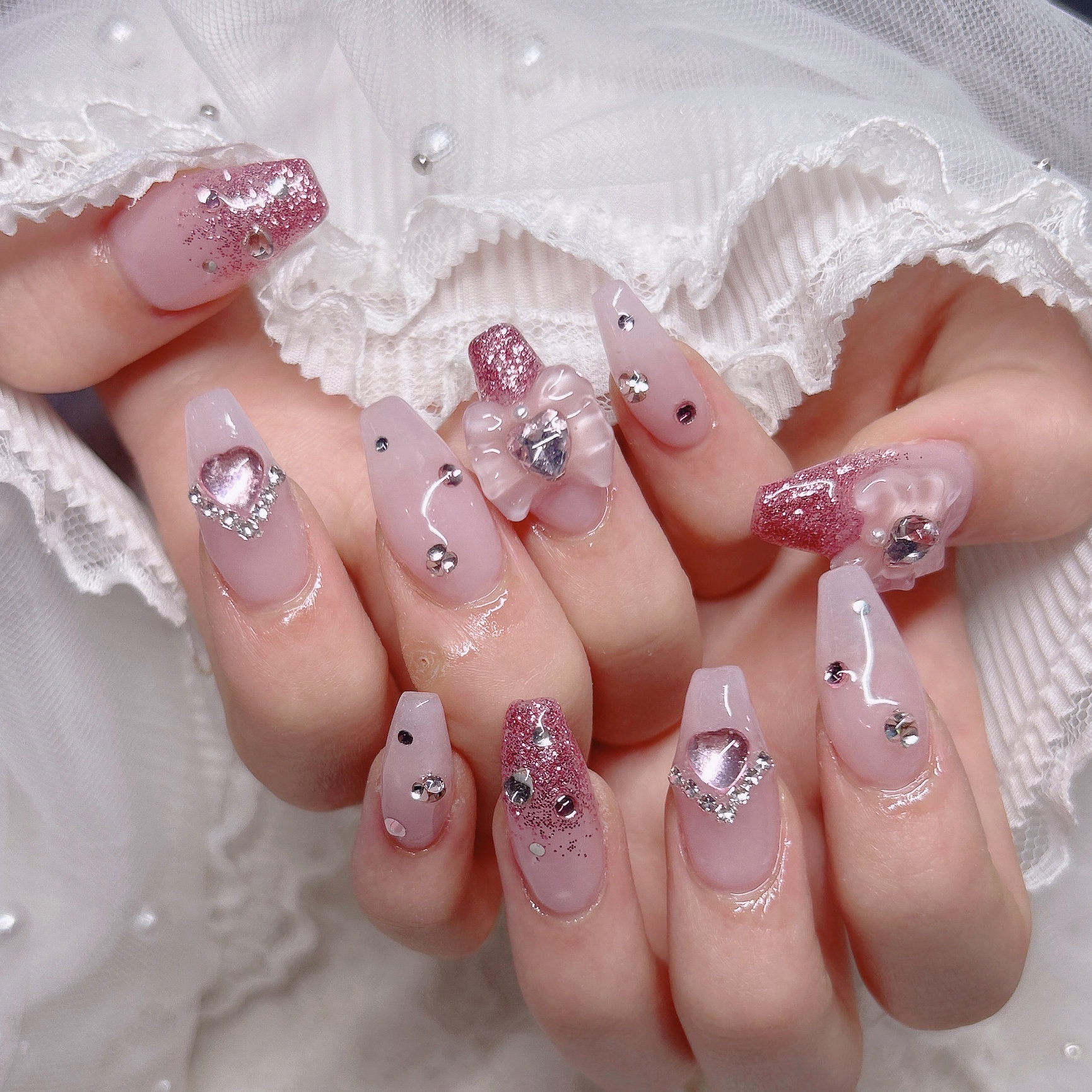 so2_ktn_yveil