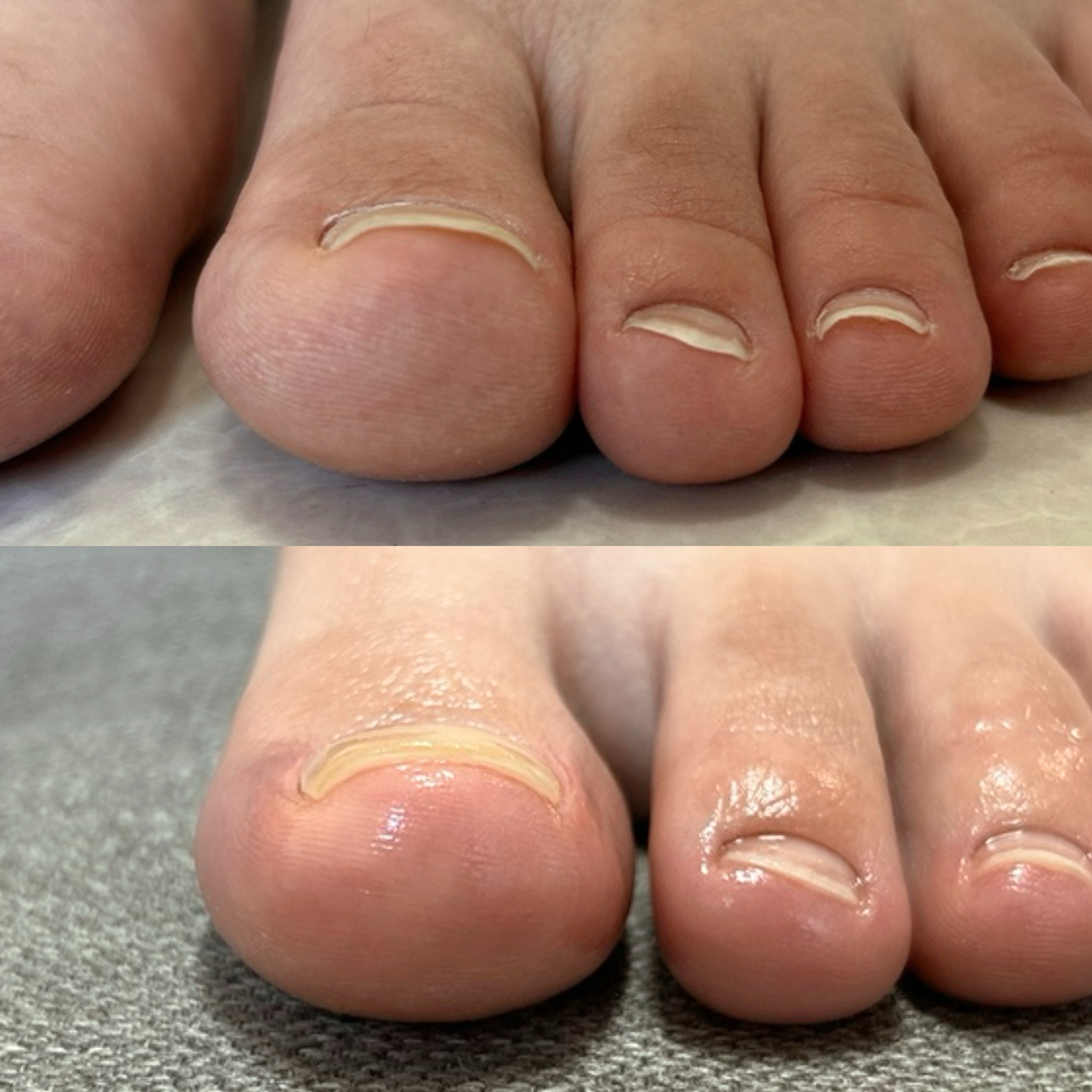 kicoco.nail
