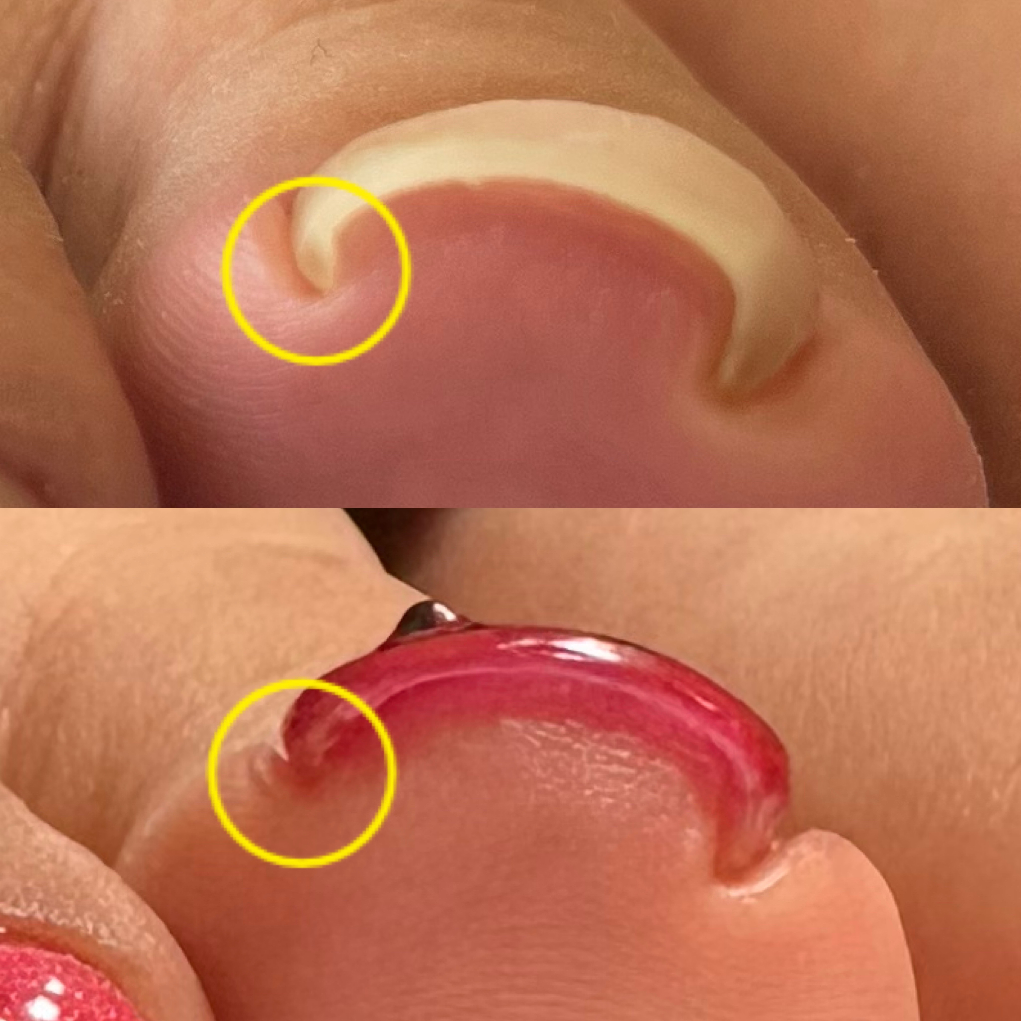 nail_abientot