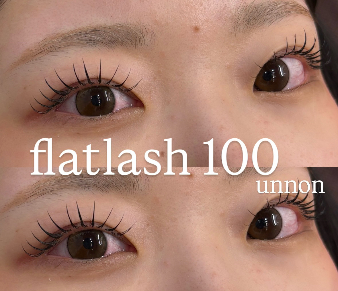 unnon_takeshita
