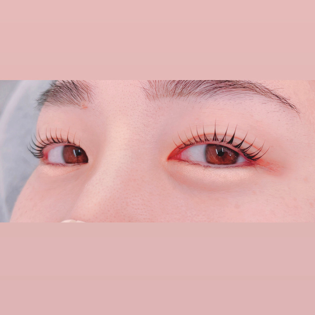 suzu_215312