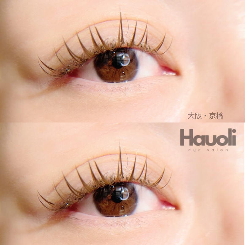 eyelist_kinjou
