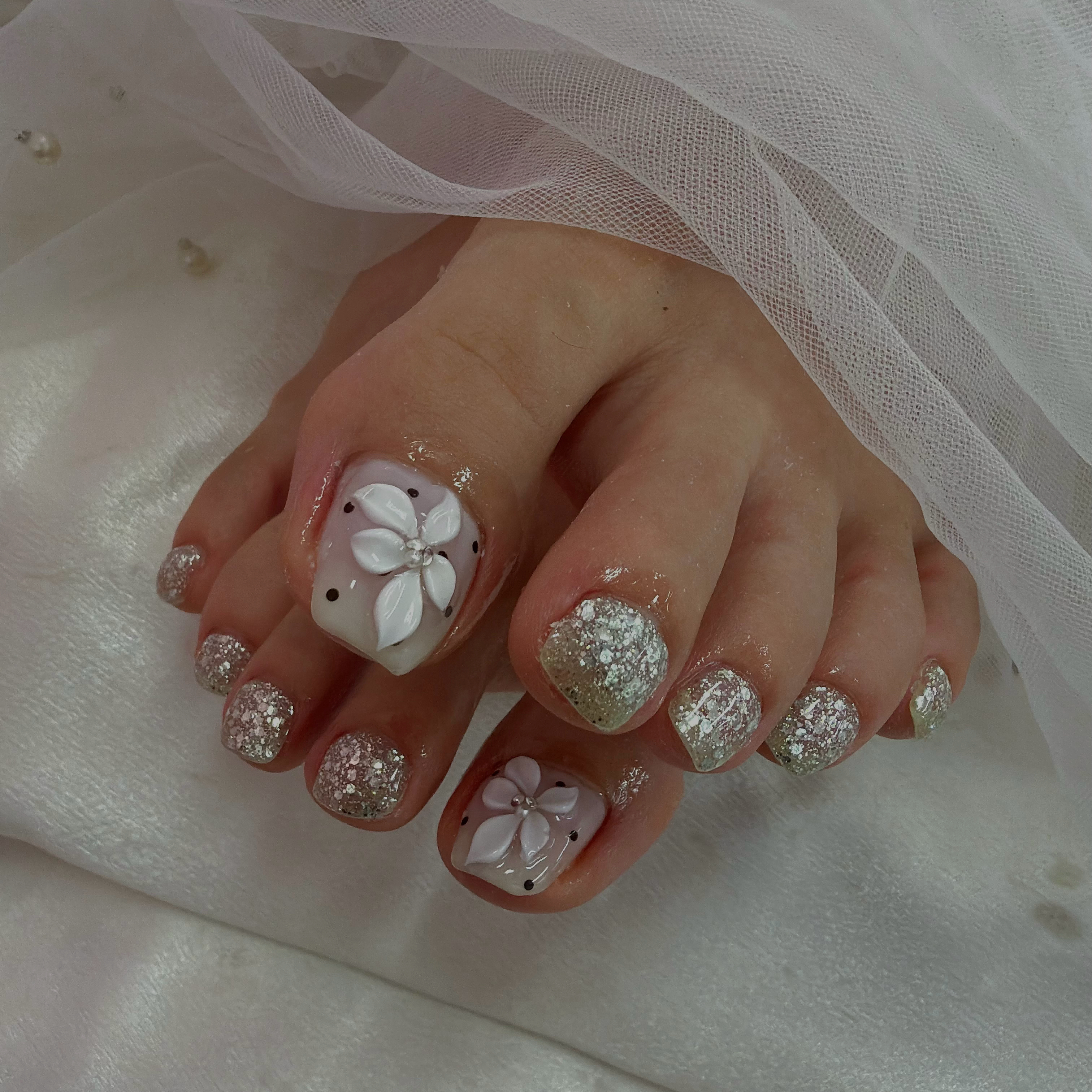 nail_mrn