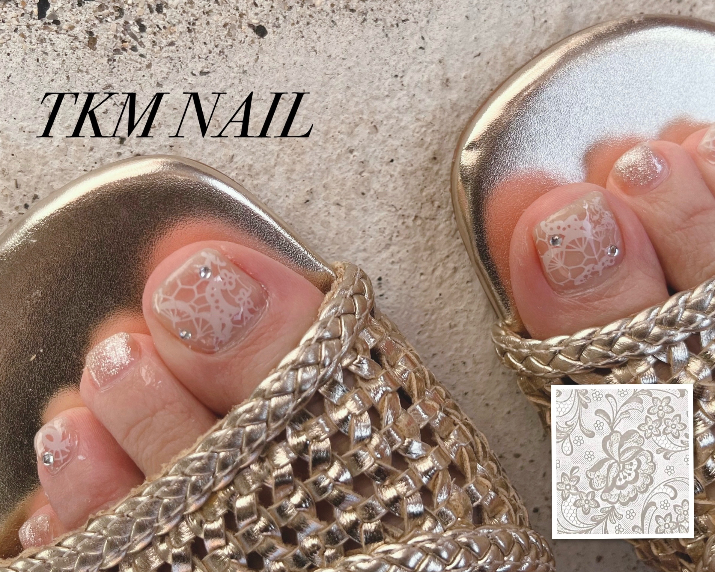 TKM_NAIL