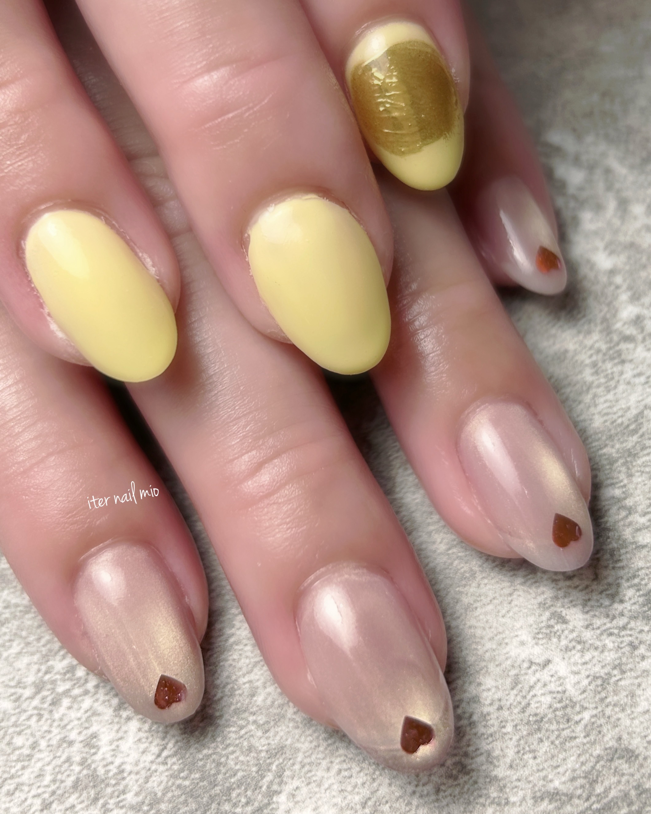iter_nail_mio