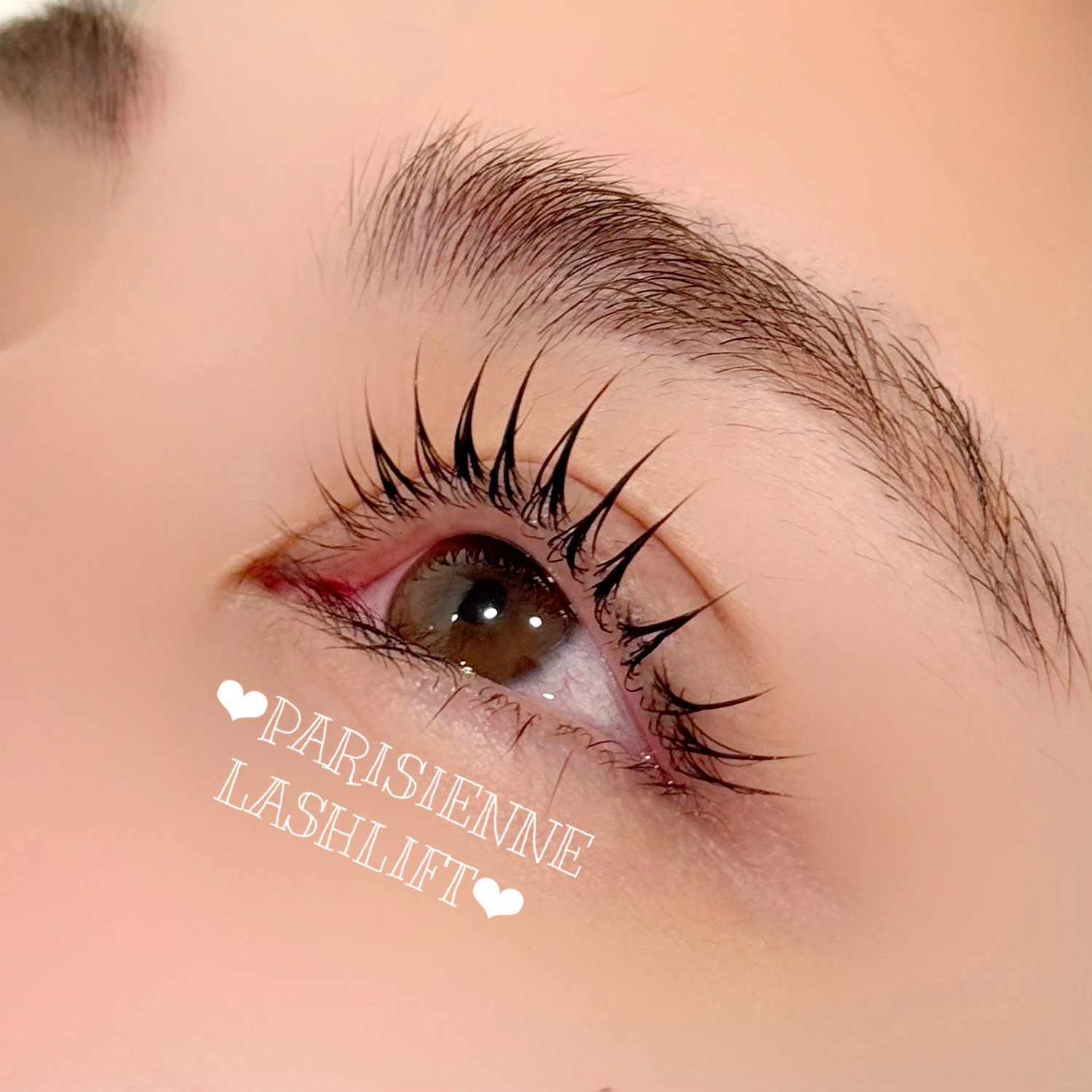 aoi_trueye
